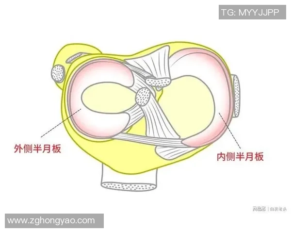打篮球导致半月板损伤的原因及预防措施详解 打篮球导致半月板损伤的原因及预防措施详解